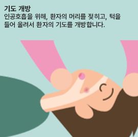 기도 개방 인공호흡을 위해, 환자의 머리를 젖히고, 턱을 들어 올려서 환자의 기도를 개방합니다.