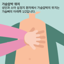 가슴압박 위치 성인과 소아 심정지 환자에서 가슴압박의 위치는 가슴뼈의 아래쪽 1/2입니다.