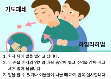 기도폐쇄 하임리히법 1. 환자 뒤에 발을 벌리고 섭니다. 2. 두 손을 환자의 명치와 배꼽 중간에 놓고 주먹을 감싸 쥐고 세게 밀어 올립니다. 3. 말을 할 수 있거나 이물질이 나올 때 까지 반복 실시합니다.